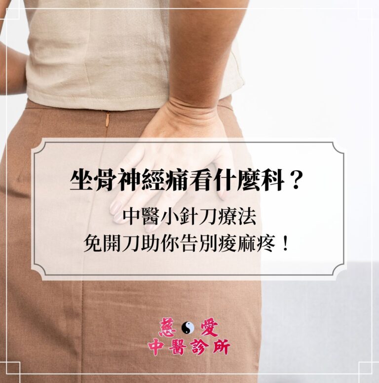 坐骨神經痛看什麼科？中醫小針刀療法免開刀助你告別痠麻疼！